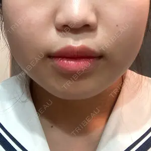 品川スキンクリニック広島院口コミ