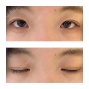 湘南美容クリニック 新潟院口コミ