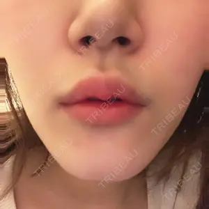 品川美容外科池袋院口コミ