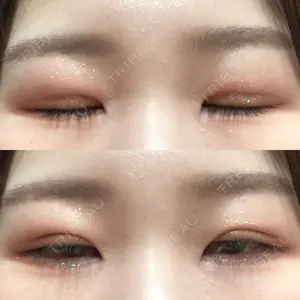 品川スキンクリニック広島院口コミ