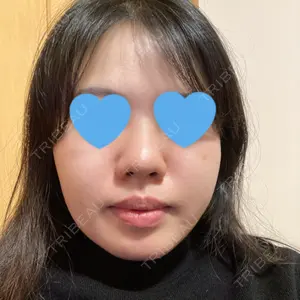 湘南美容クリニック 名古屋院口コミ