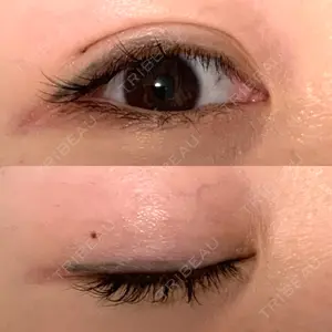 札幌ル・トロワ ビューティクリニックVogue口コミ