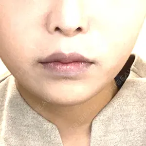 リッツ美容外科 東京院口コミ