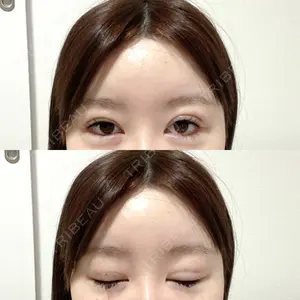 CLASSY 仙台美容外科・美容皮膚科口コミ