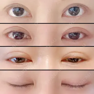 エイペックス美容外科口コミ