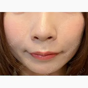 今泉スキンクリニック口コミ