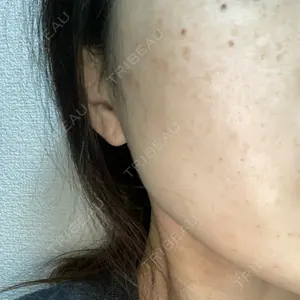 JMスマイルクリニック口コミ