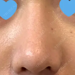エイペックス美容外科口コミ