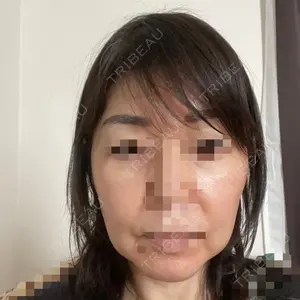 品川美容外科 梅田院口コミ