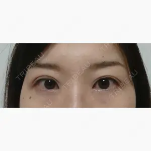 心斎橋コムロ美容外科クリニック口コミ