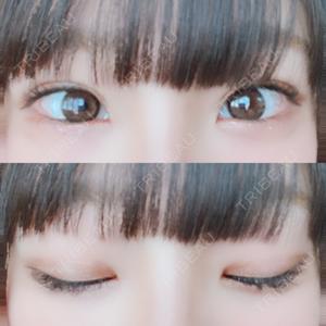 湘南美容クリニック 奈良院口コミ