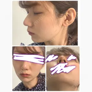 ヒルズ美容クリニック口コミ