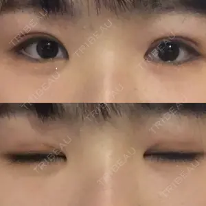 CLASSY 仙台美容外科・美容皮膚科口コミ