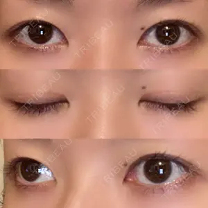 蘇春堂形成外科口コミ