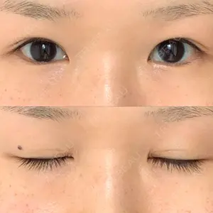 銀座高須クリニック口コミ