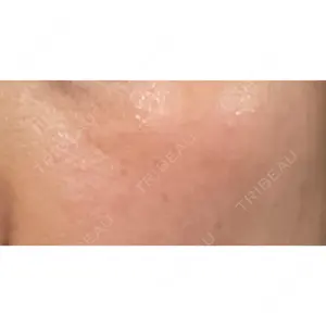 PICO BEAUTY CLINIC口コミ