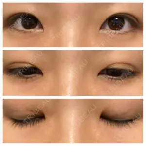 銀座高須クリニック口コミ