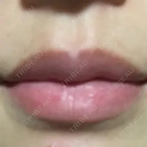 Wクリニック 心斎橋院口コミ