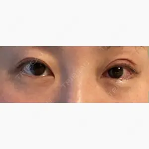 くさのたろうクリニック口コミ