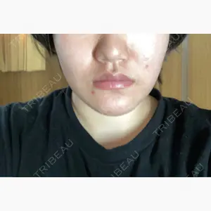 S Beauty Clinic口コミ