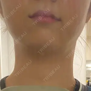アサミ美容外科 渋谷院口コミ