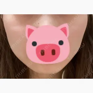アサミ美容外科 渋谷院口コミ