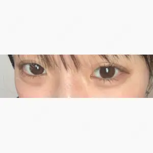 ツツイ美容外科口コミ