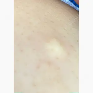 湘南美容クリニック 横須賀中央院口コミ