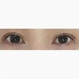 みやび形成外科口コミ
