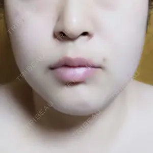 なな歯科クリニック口コミ