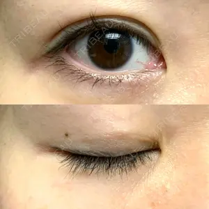 札幌ル・トロワ ビューティクリニックVogue口コミ