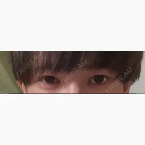 湘南美容クリニック 広島院口コミ