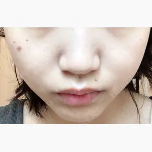 品川美容外科 名古屋院口コミ