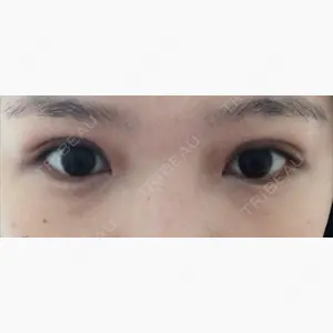 品川美容外科 名古屋院口コミ