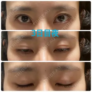 オジスキンクリニック口コミ