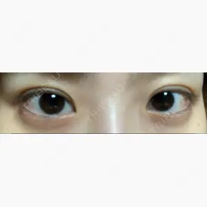 烏丸御池ビューティークリニック口コミ