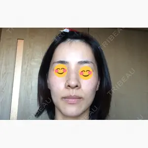 id（アイディ）美容外科口コミ