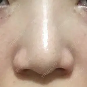 シエルクリニック口コミ