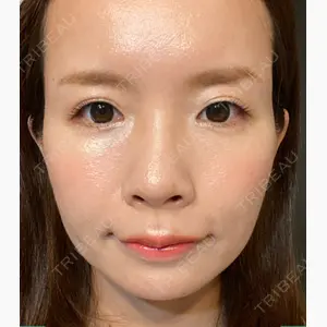 今泉スキンクリニック口コミ