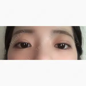 品川美容外科 札幌院口コミ