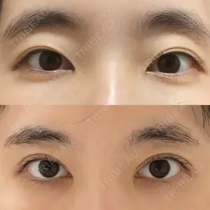 品川美容外科 梅田院口コミ