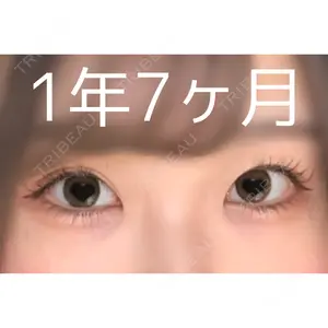 ヒルズ美容クリニック口コミ