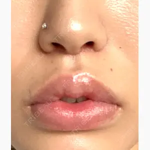 ナチュレ美容クリニック口コミ