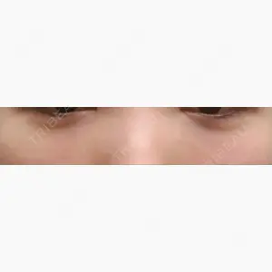 湘南美容クリニック 高松院口コミ