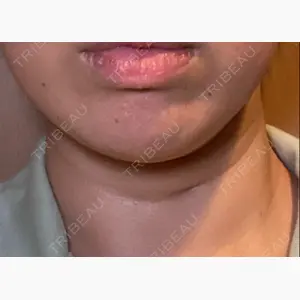 プライベートクリニック恵比寿口コミ