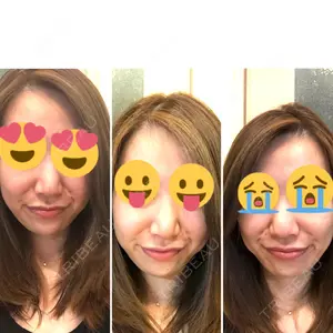 SUEクリニック銀座口コミ