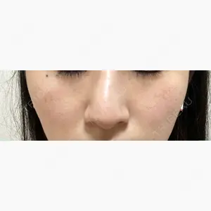 JMスマイルクリニック口コミ