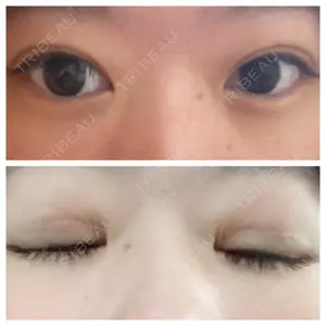 品川美容外科 名古屋院口コミ