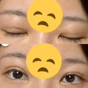 ドクターゴールドマンクリニック 大阪院口コミ