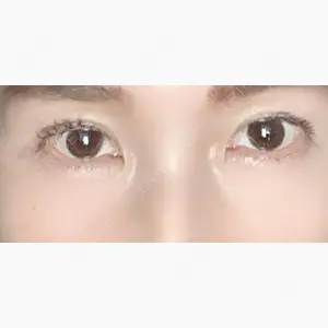 高田眼科併設眼瞼下垂治療センター口コミ